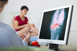 osteoartritis, diagnoza