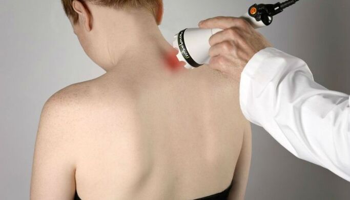 fizioterapevtsko zdravljenje bolečin v vratu