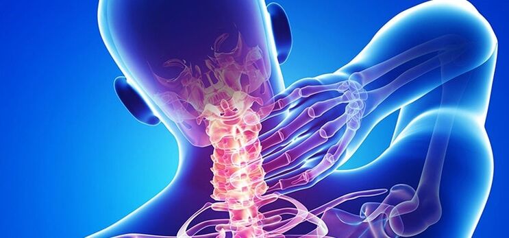 osteohondroza vratne hrbtenice