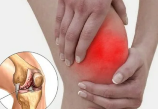 Kaj se zgodi, ko artritis