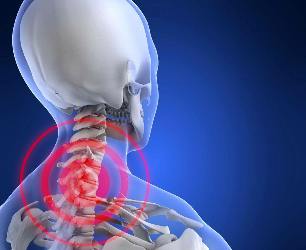 Lokacija bolečine v vratnih osteochondrosis